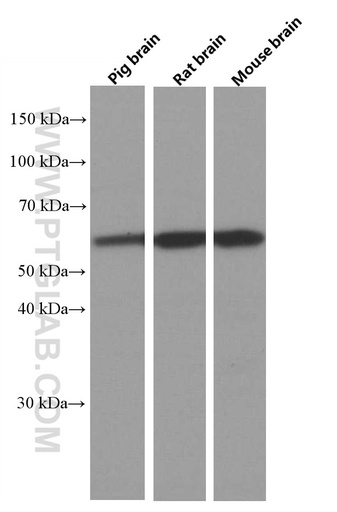 [66614-1-IG-150UL] PPP3CB Monoclonal antibody
