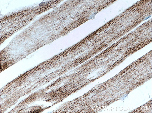 [66615-1-IG-20UL] PC Monoclonal antibody