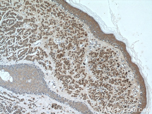 [66616-1-IG-150UL] S100 Beta Monoclonal antibody