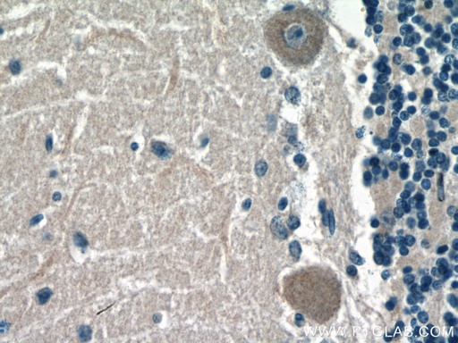 [66617-1-IG-20UL] ACSL4 Monoclonal antibody