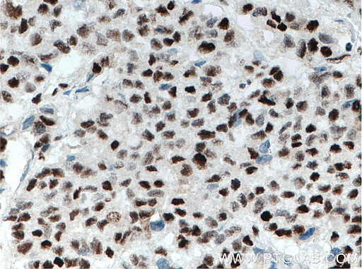 [66621-1-IG-150UL] XRCC4 Monoclonal antibody
