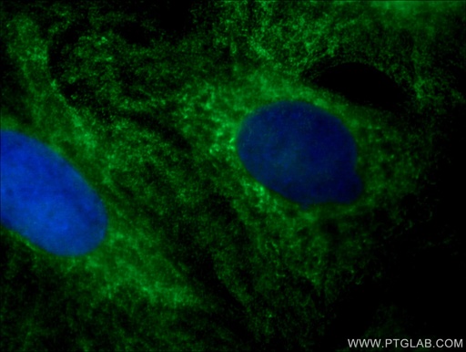 [66622-1-IG-20UL] RABEPK/p40 Monoclonal antibody