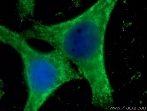 [66624-1-IG-20UL] GSTA1 Monoclonal antibody