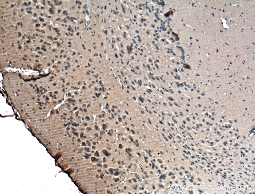 [66625-1-IG-20UL] RIC8A Monoclonal antibody