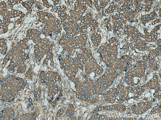 [66628-1-IG-20UL] ACTN4 Monoclonal antibody