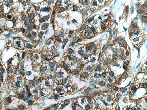 [66629-1-IG-20UL] FAF2 Monoclonal antibody