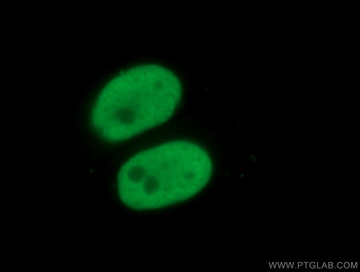 [66630-1-IG-150UL] KAP1 Monoclonal antibody