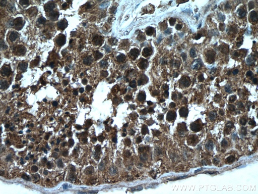[66632-1-IG-20UL] NEK2 Monoclonal antibody