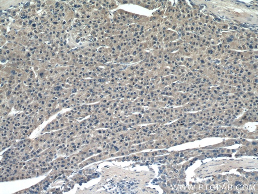 [66633-1-IG-20UL] ROCK2 Monoclonal antibody