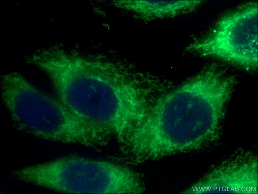 [66635-1-IG-20UL] FIS1 Monoclonal antibody