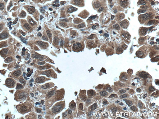 [66638-1-IG-20UL] p70(S6K) Monoclonal antibody