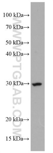 [66640-1-IG-150UL] CD302 Monoclonal antibody