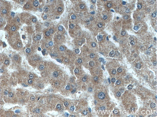 [66641-1-IG-150UL] ANGPTL8 Monoclonal antibody