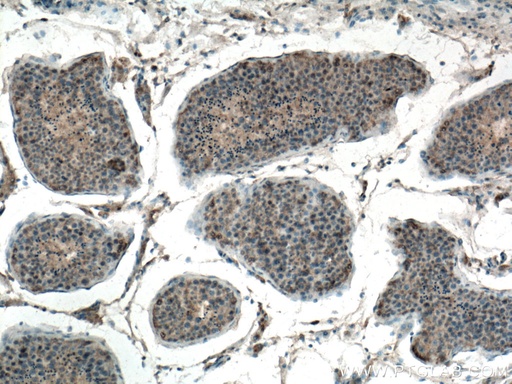 [66646-1-IG-150UL] EIF2AK2 Monoclonal antibody