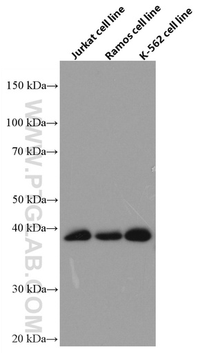 [66647-1-IG-20UL] RNF126 Monoclonal antibody