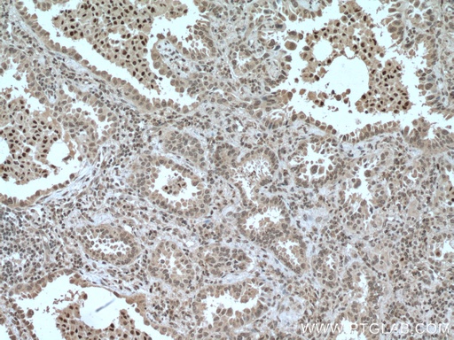[66649-1-IG-150UL] CEBPB Monoclonal antibody
