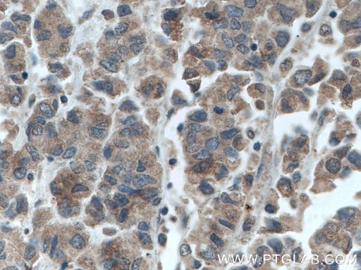 [66651-1-IG-150UL] GRASP65,GORASP1 Monoclonal antibody