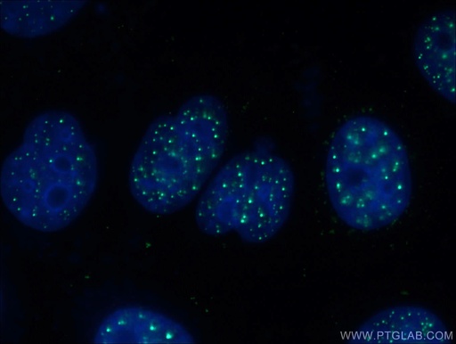 [66652-1-IG-20UL] XRCC2 Monoclonal antibody