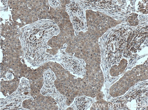 [66661-1-IG-20UL] BAG6 Monoclonal antibody