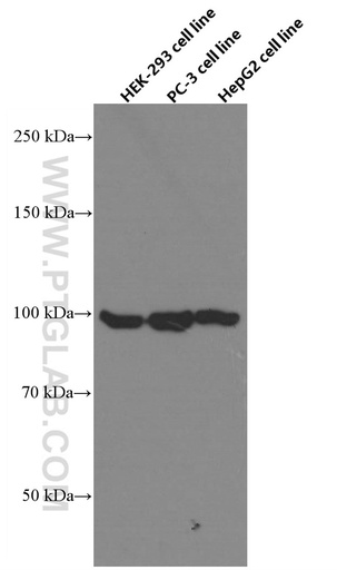 [66664-1-IG-20UL] DDX54 Monoclonal antibody