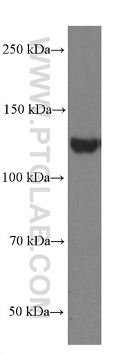 [66667-1-IG-20UL] EPHA7 Monoclonal antibody