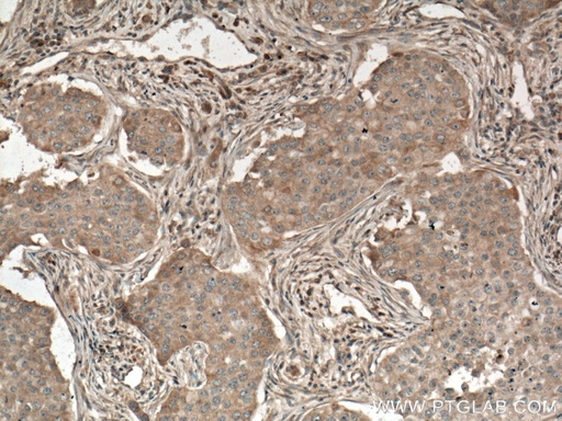 [66668-1-IG-150UL] PLCB3 Monoclonal antibody