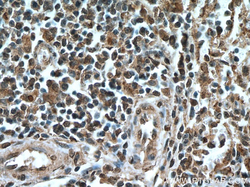 [66670-1-IG-150UL] IRF3 Monoclonal antibody