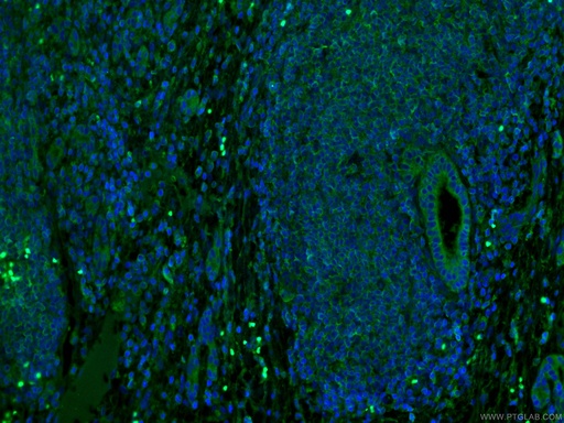 [66675-1-IG-20UL] MLKL Monoclonal antibody