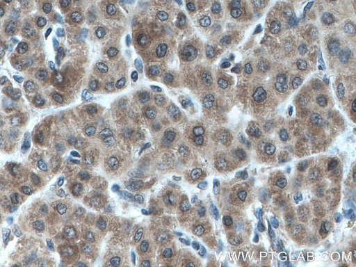 [66677-1-IG-20UL] AKR7A2 Monoclonal antibody