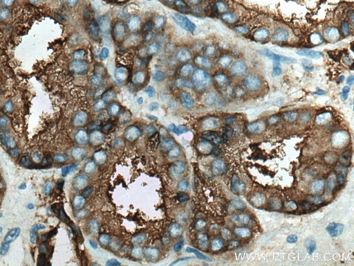 [66678-1-IG-20UL] PSMA/GCPII Monoclonal antibody