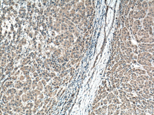 [66679-1-IG-150UL] BBS10 Monoclonal antibody