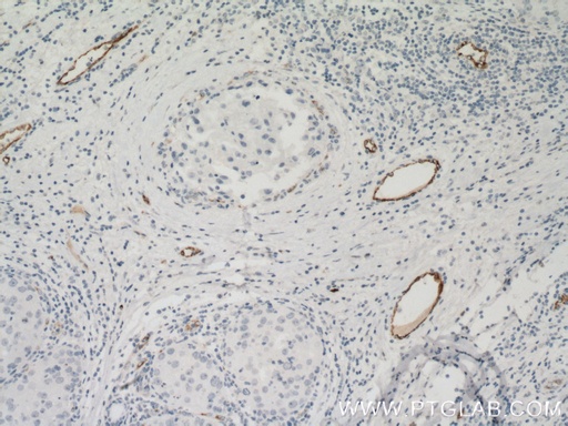 [66682-1-IG-150UL] vwf Monoclonal antibody