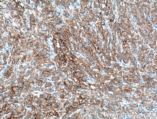 [66685-1-IG-20UL] Cytokeratin 6A Monoclonal antibody