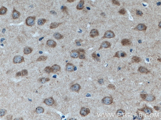 [66688-1-IG-20UL] RAB3GAP1 Monoclonal antibody