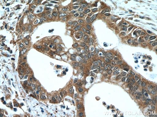 [66691-1-IG-20UL] NEUROD1 Monoclonal antibody