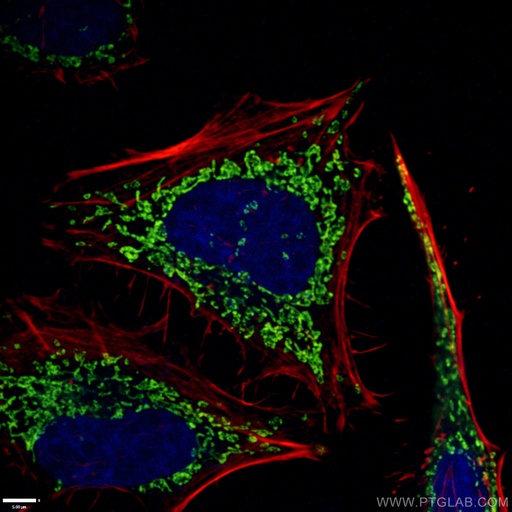 [66696-1-IG-150UL] ATP5O Monoclonal antibody
