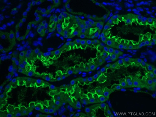 [66699-1-IG-150UL] ACE2 Monoclonal antibody