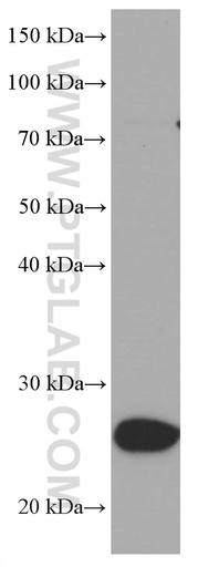 [66700-1-IG-150UL] UCP2 Monoclonal antibody