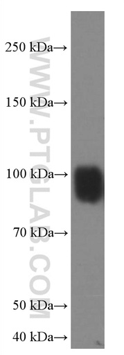 [66704-1-IG-20UL] IFNGR1 Monoclonal antibody