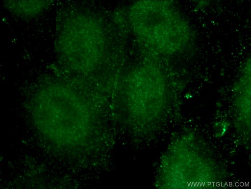 [66705-1-IG-20UL] LIG4 Monoclonal antibody
