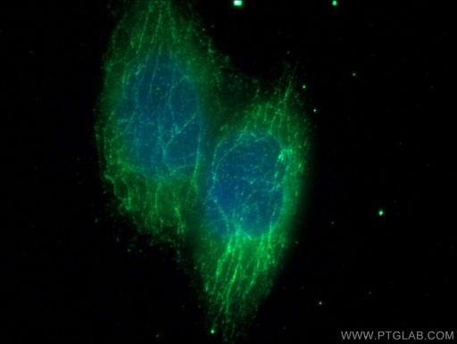 [66706-1-IG-20UL] MTAP Monoclonal antibody