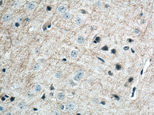 [66709-1-IG-20UL] MAG Monoclonal antibody