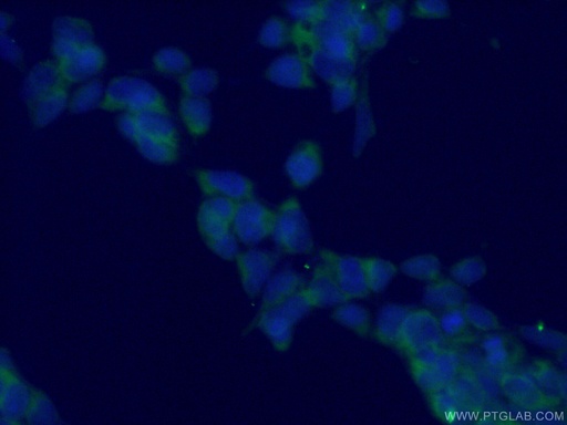 [66713-1-IG-150UL] TPT1 Monoclonal antibody