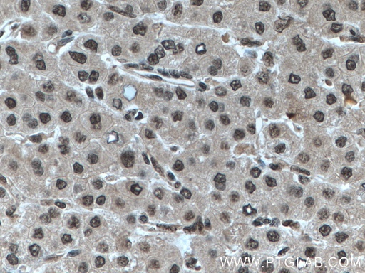 [66716-1-IG-20UL] RBX1 Monoclonal antibody
