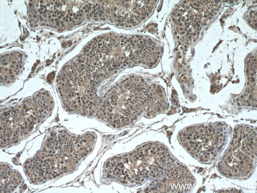 [66718-1-IG-150UL] CHCHD4 Monoclonal antibody