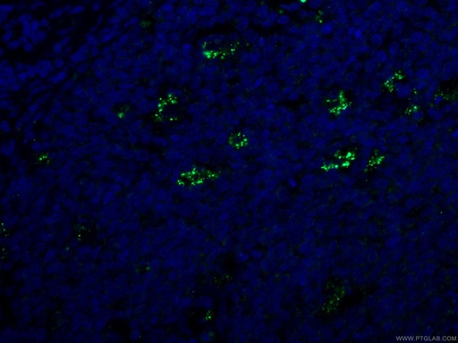[66721-1-IG-20UL] SYK Monoclonal antibody