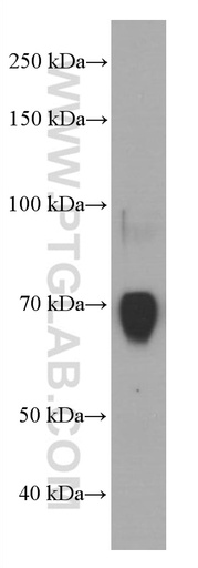 [66722-1-IG-150UL] F8 Monoclonal antibody