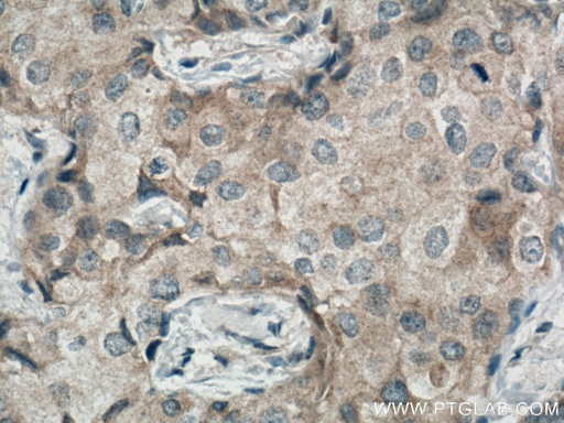 [66724-1-IG-20UL] MRPS27 Monoclonal antibody