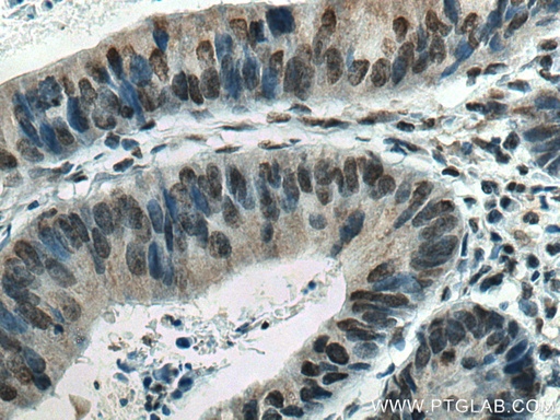 [66731-1-IG-20UL] EPAS1 Monoclonal antibody