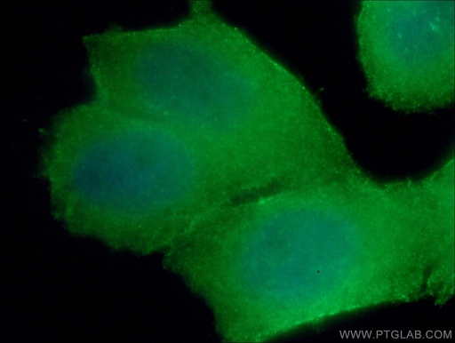 [66733-1-IG-150UL] RHOA Monoclonal antibody